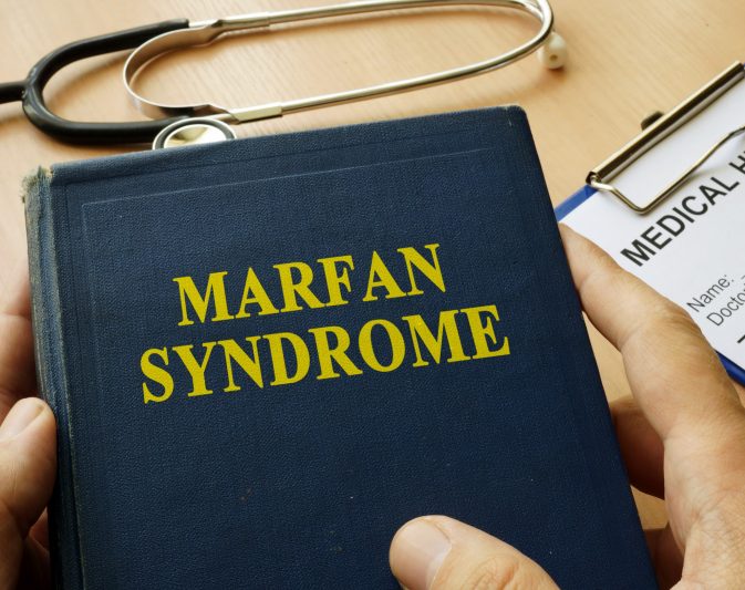 Marfan Syndrome