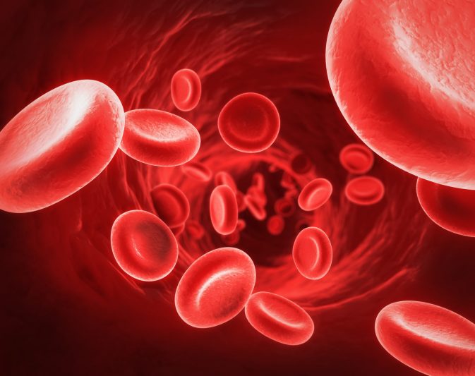 Myelofibrosis